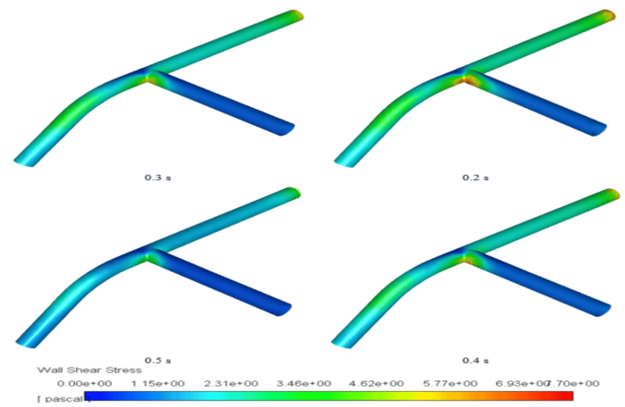 Non Newtonian Blood Pulse Flow in a Vein, ANSYS Fluent CFD Training ...