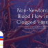 Non Newtonian Blood Flow In A Clogged Vessel Cfd Simulation Ansys
