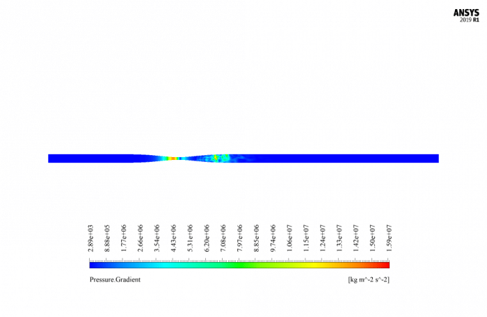 Blood Flow in Clogged Artery CFD Simulation by ANSYS Fluent Training ...