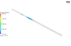 Blood Flow in Clogged Artery CFD Simulation by ANSYS Fluent Training ...