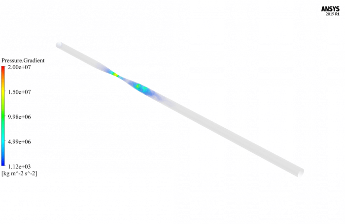 Blood Flow in Clogged Artery CFD Simulation by ANSYS Fluent Training ...