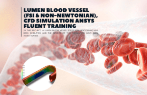 Lumen Blood Vessel (FSI & Non-Newtonian), CFD Simulation Ansys Fluent ...