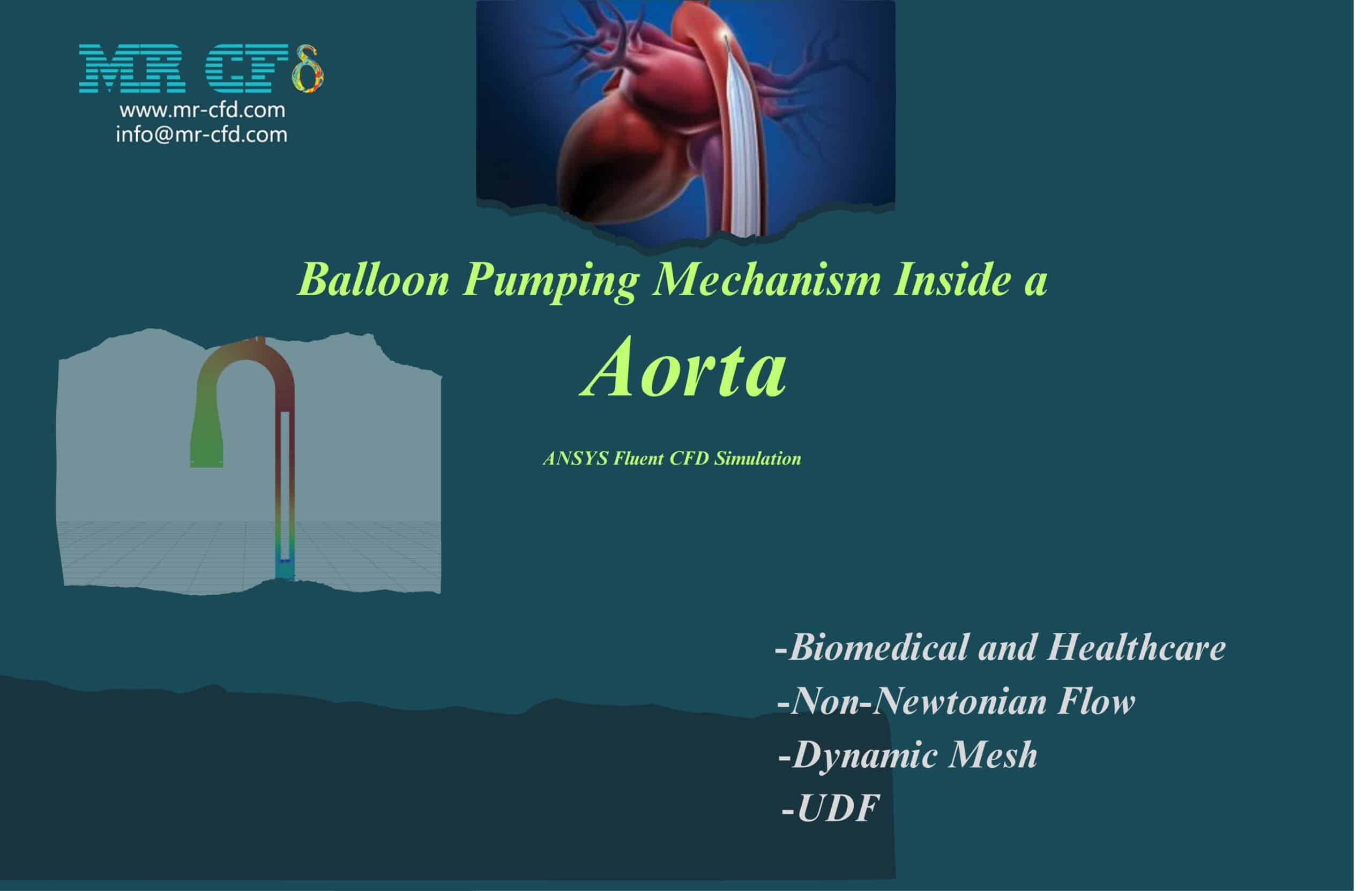Balloon Pumping Mechanism Inside an Aorta