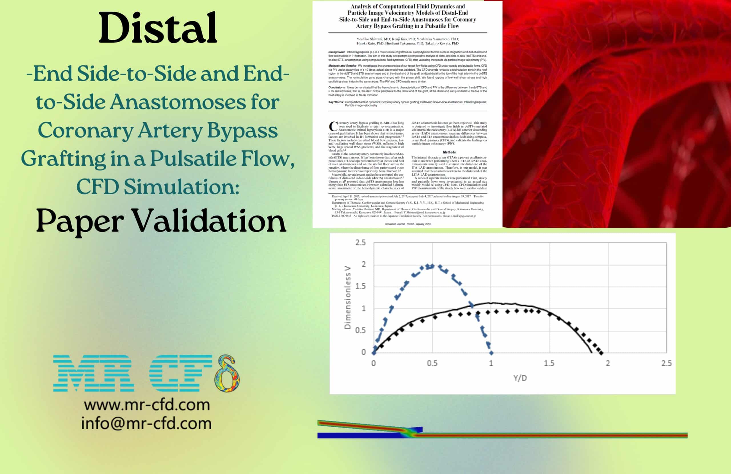 Distal-End Side-to-Side and End-to-Side Anastomoses for Coronary Artery Bypass Grafting in a Pulsatile Flow, CFD Simulation: Paper Validation